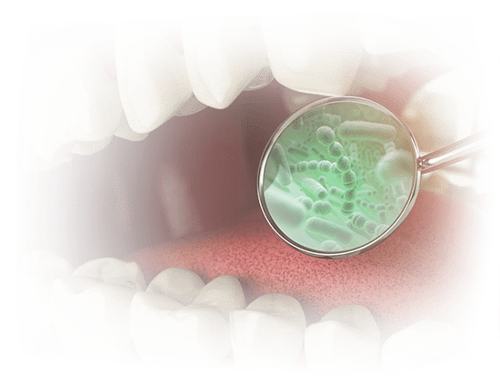 gum disease graphic