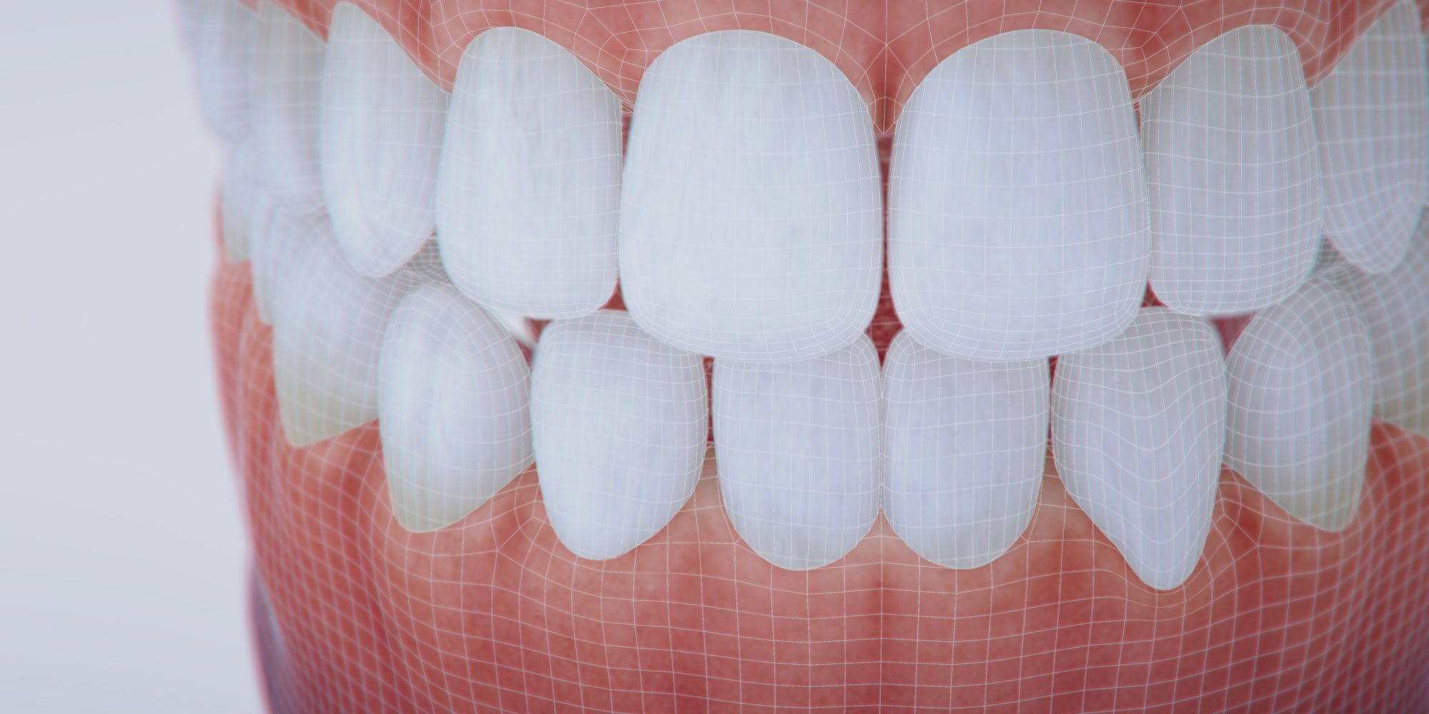 Bite Adjustment Albuquerque, NM Precision Dental Care