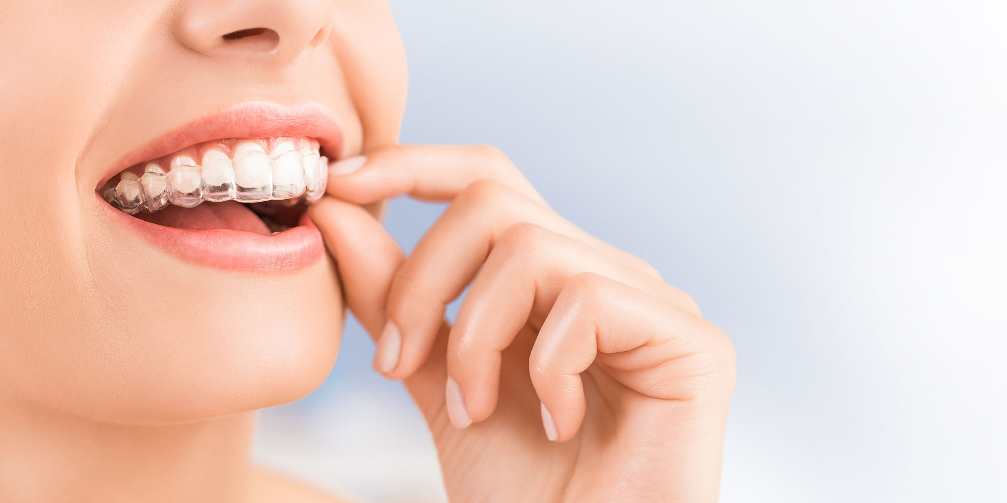 Othodontics Precision Dental Care