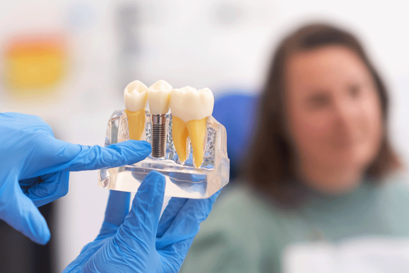 Close-up of dental model with implant. patient of dental clinic on blurred background. dentistry